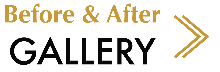 before-after