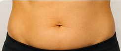 Before BodySculpt